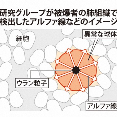 被爆から「70年後も内部被ばく」確認　長崎大など研究グループ発表