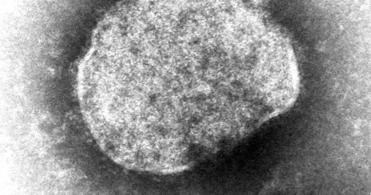 Editorial: Japan must not downplay rising measles cases and take steady action