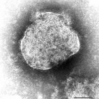 A measles virus is seen in this image provided by the Japan Institute for Health Security.
