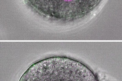 父方のゲノム（緑色）と母方のゲノム（紫色）が二つの前核に分かれている通常の受精卵（上）と父方と母方のゲノムを人工的に一つの前核にまとめた受精卵の顕微鏡画像（理化学研究所提供・共同）