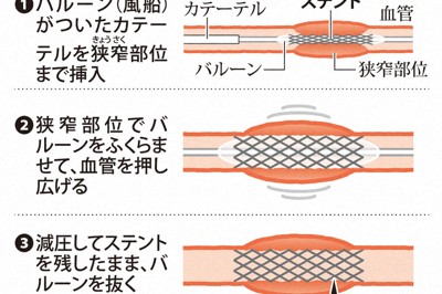 醫療用假髮沙龍：陪伴病患、讓顧客重拾笑容