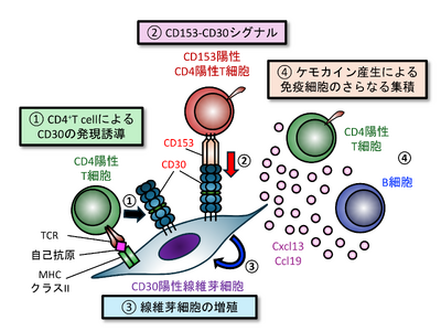 プレスリリース：［徳島大学］自己免疫疾患の進行を加速する新